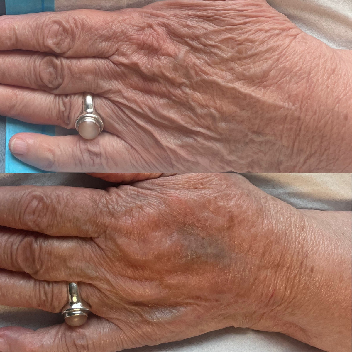 Treatment result
