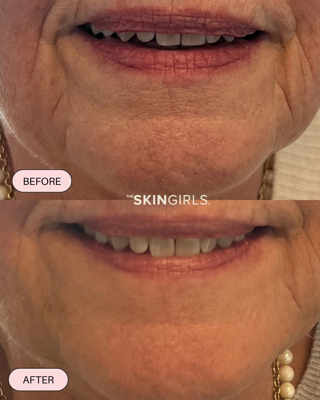 Treatment result