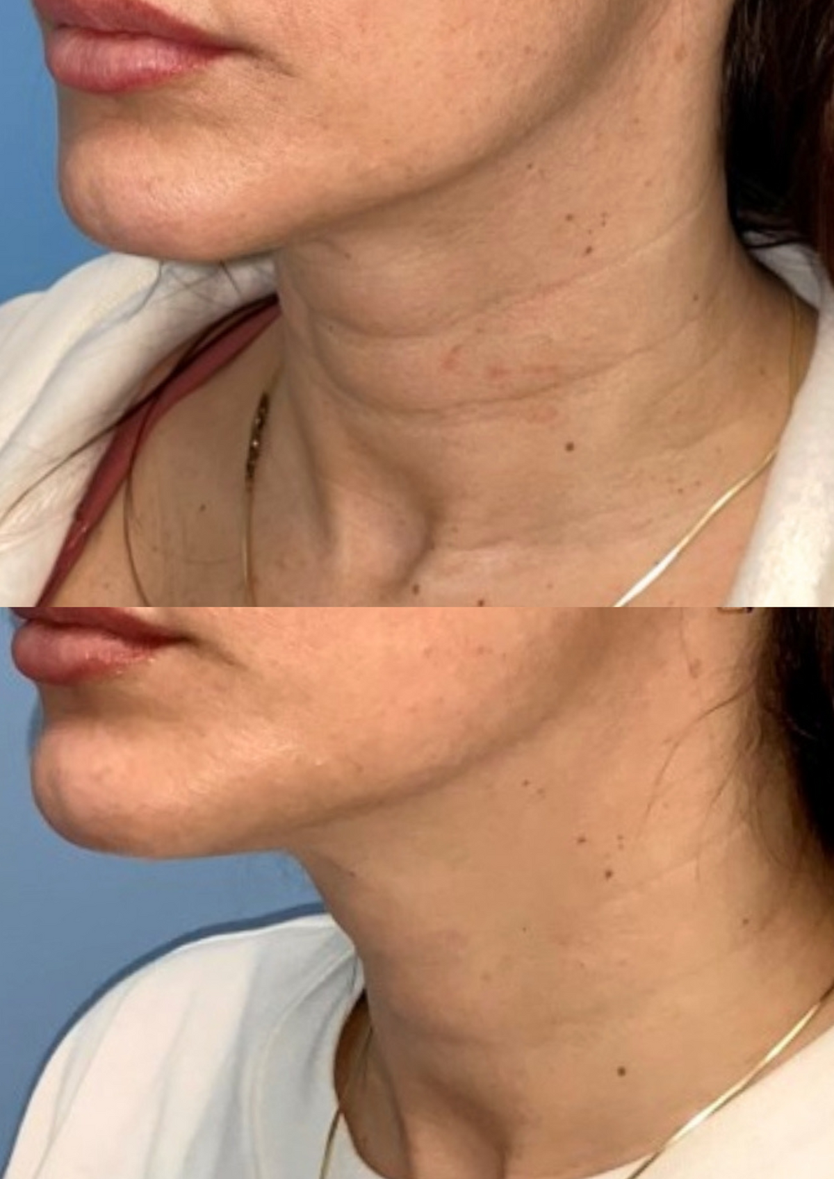 Treatment result