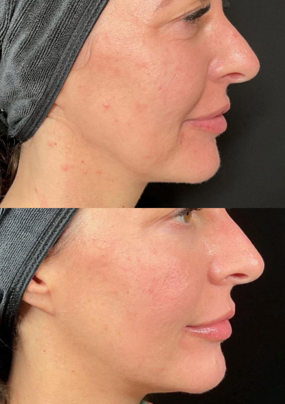 Treatment result