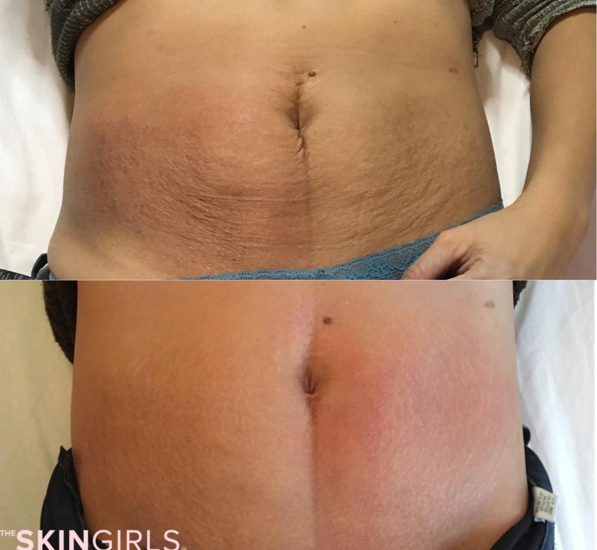 Treatment result