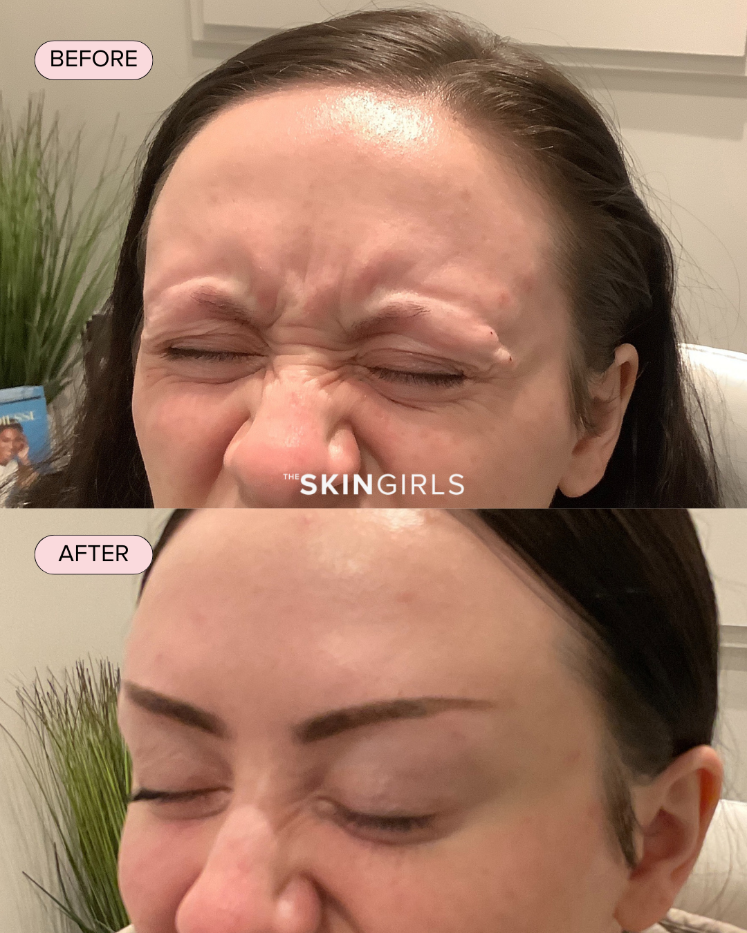 Treatment result