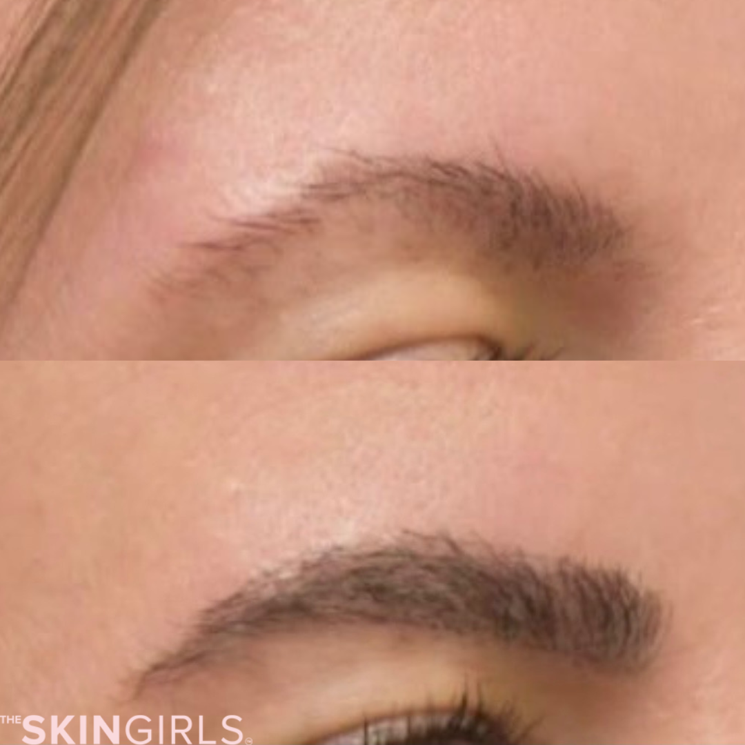 Treatment result