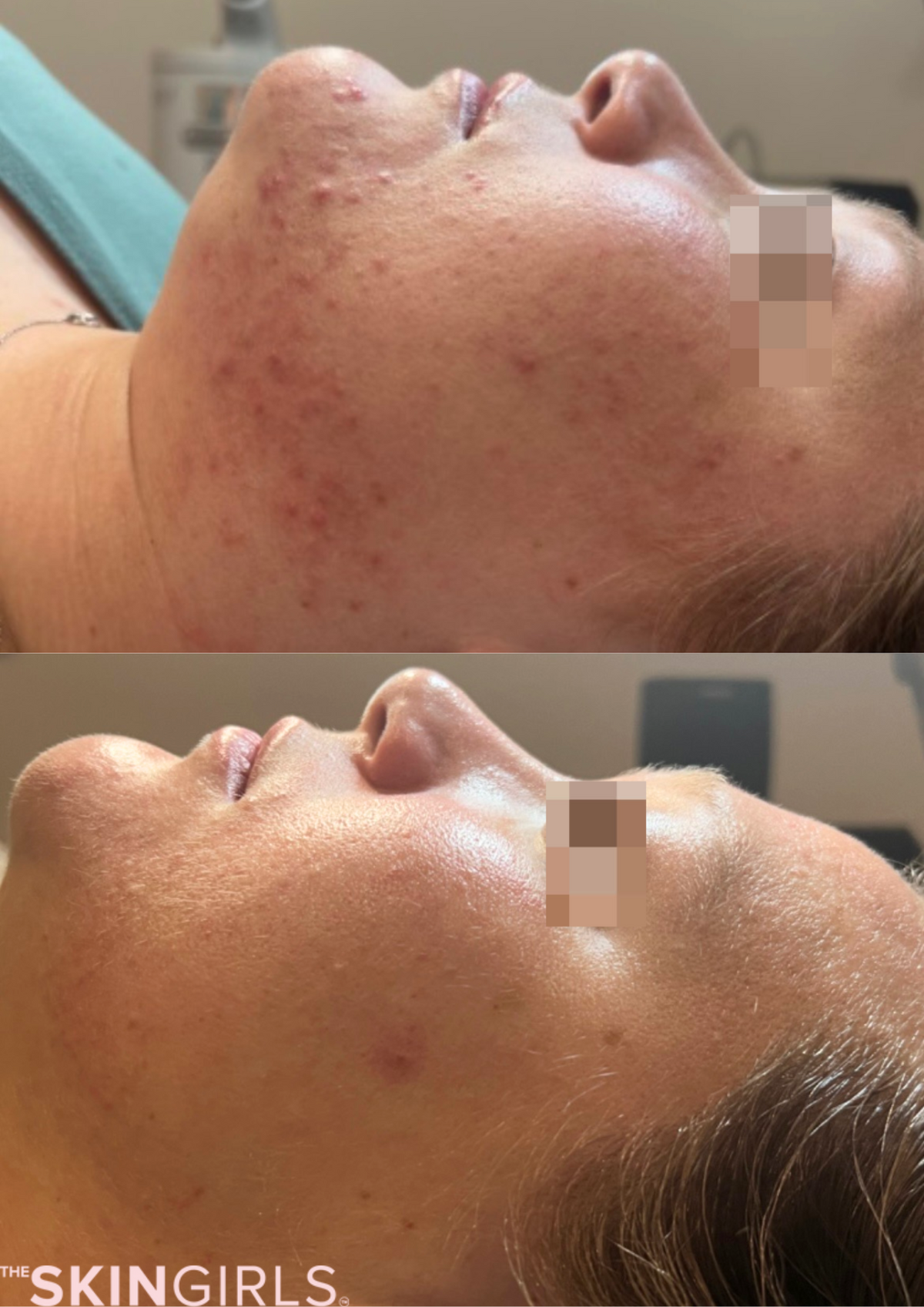 Treatment result