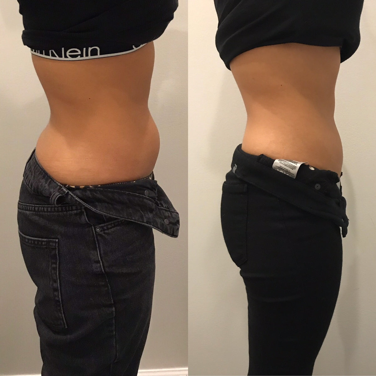 Treatment result