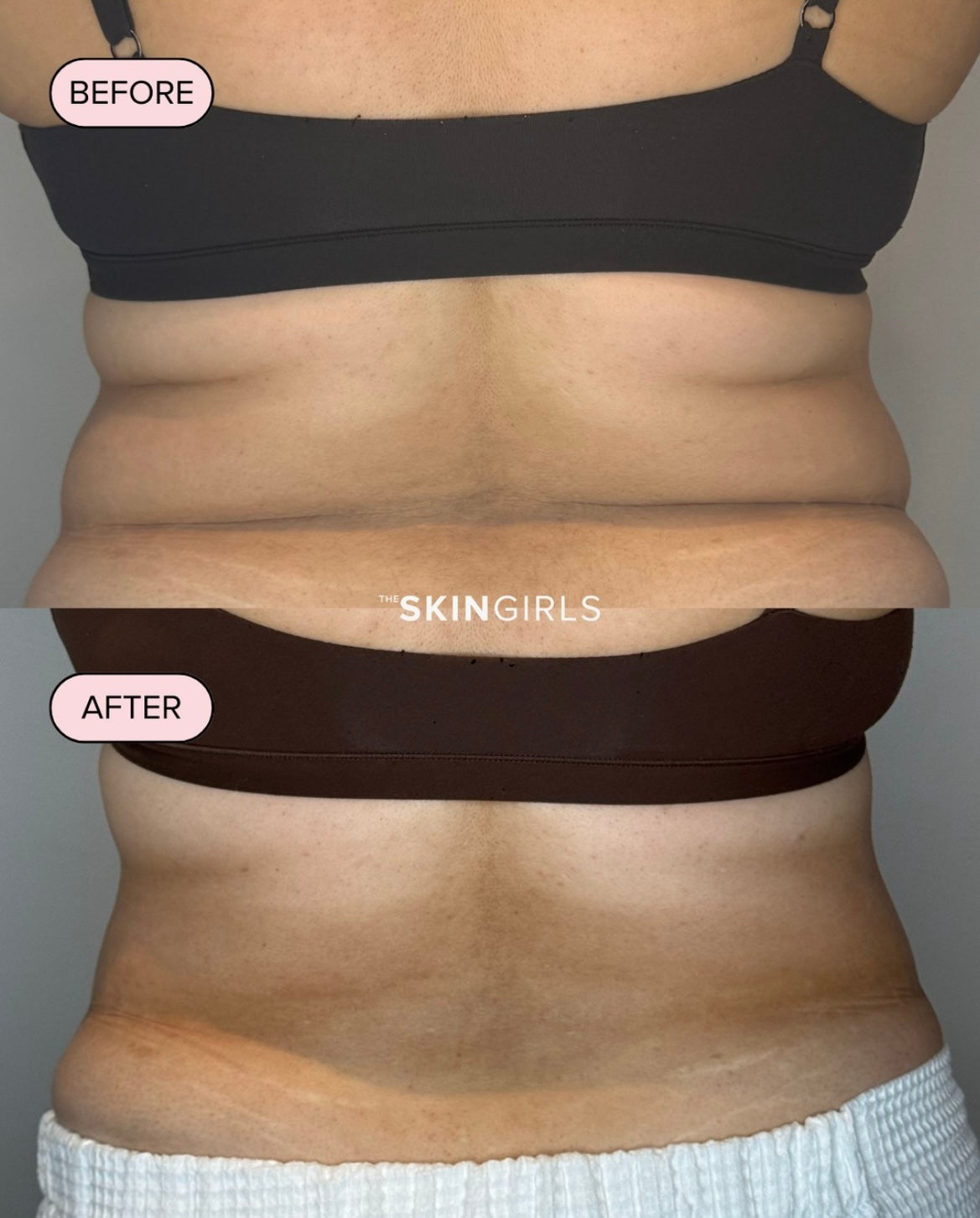 Treatment result