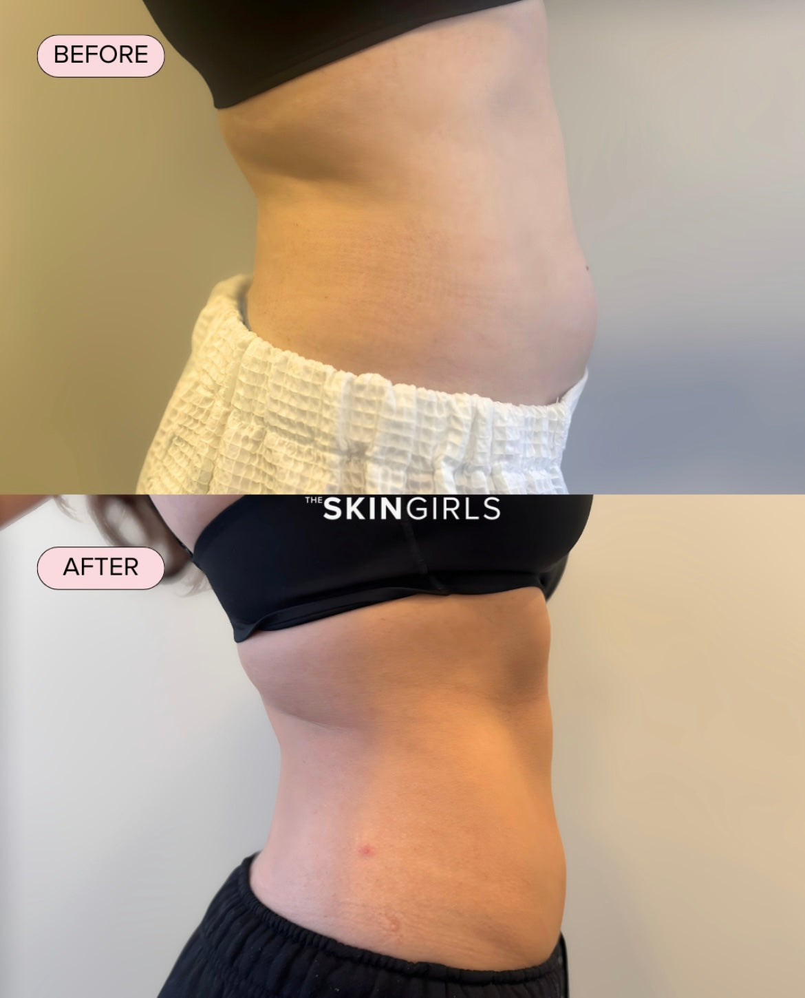 Treatment result