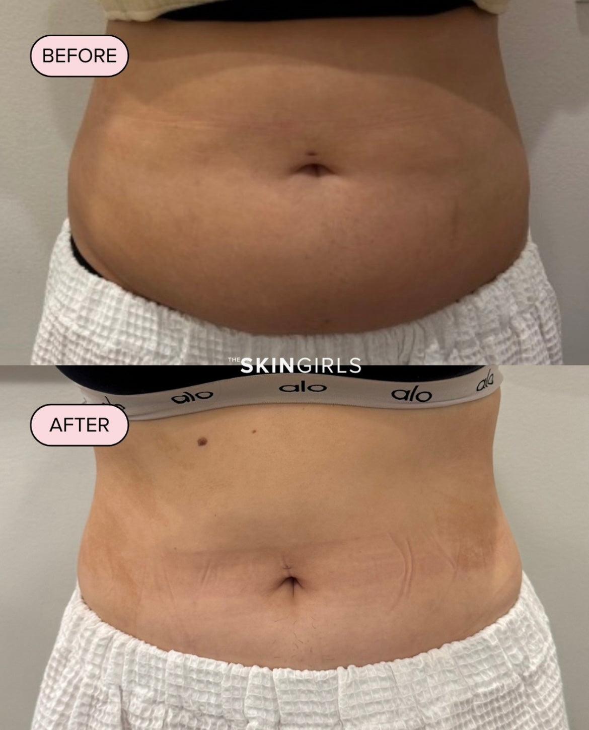 Treatment result