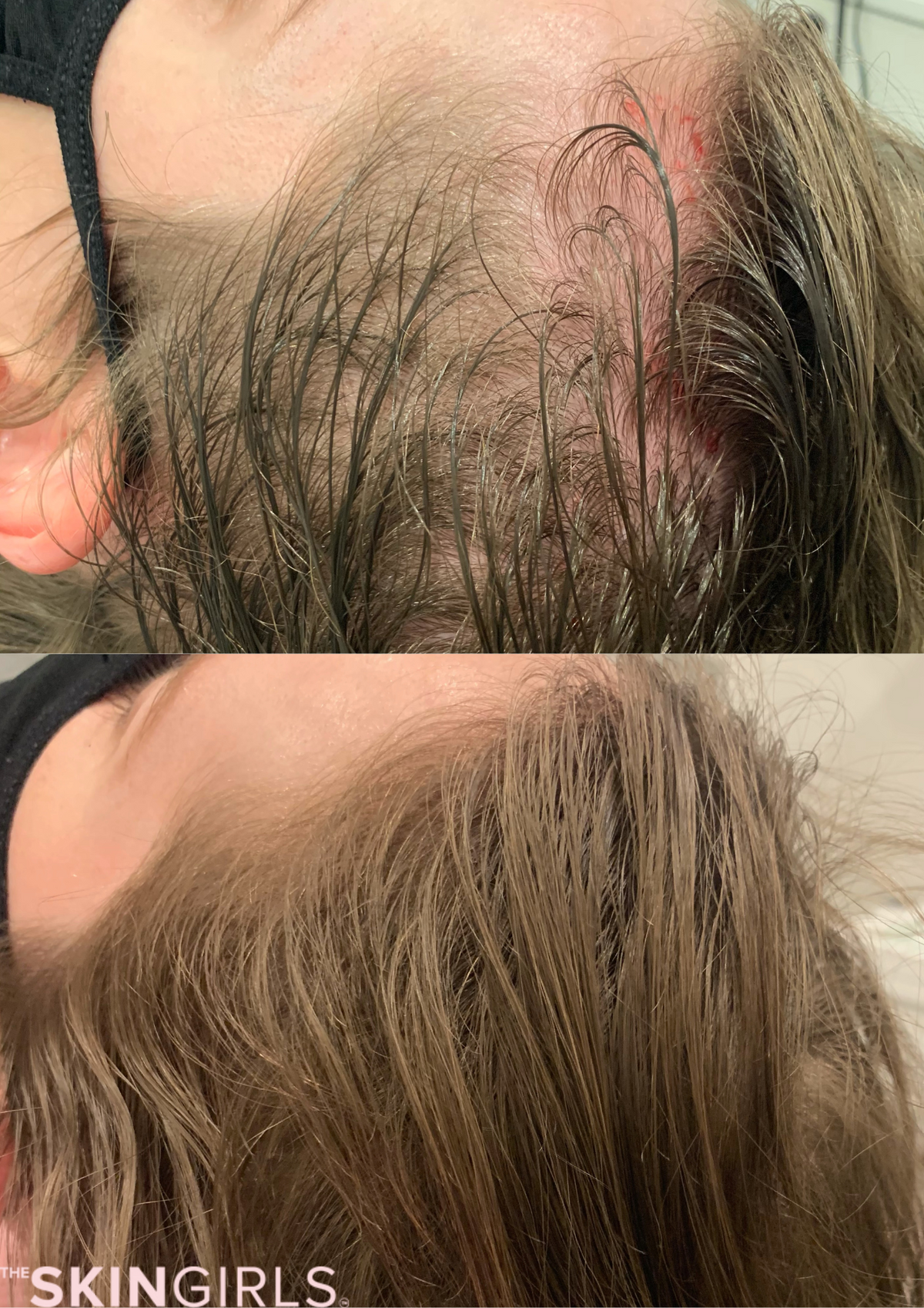Treatment result