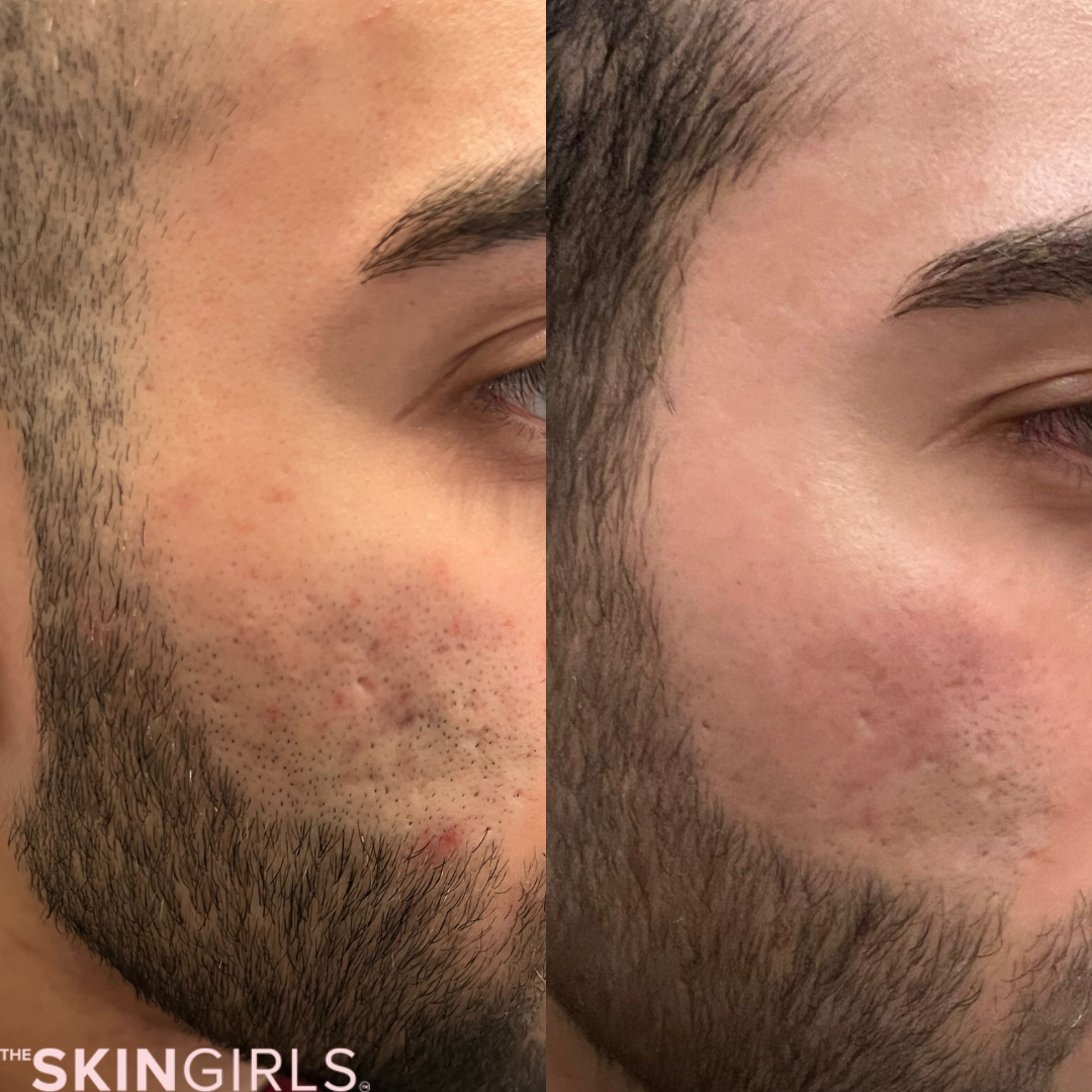 Treatment result
