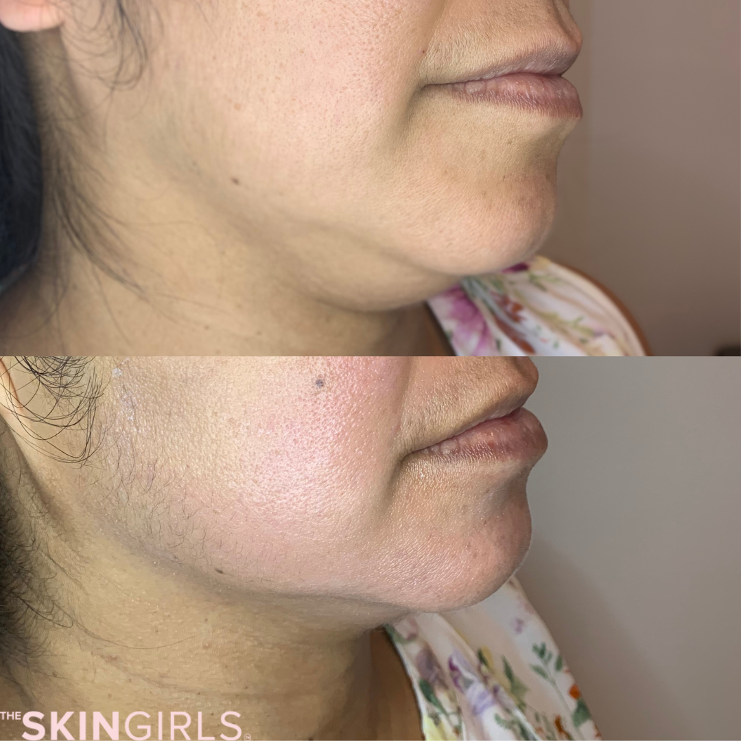 Treatment result