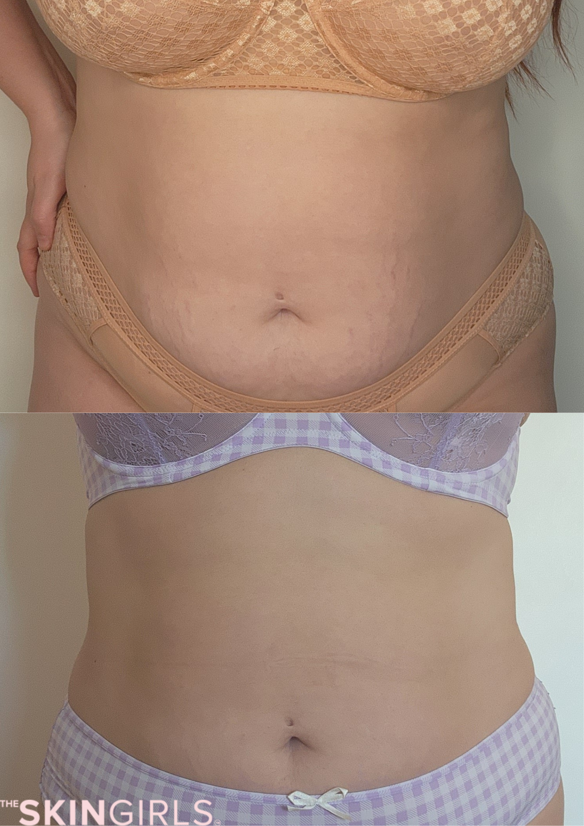 Treatment result