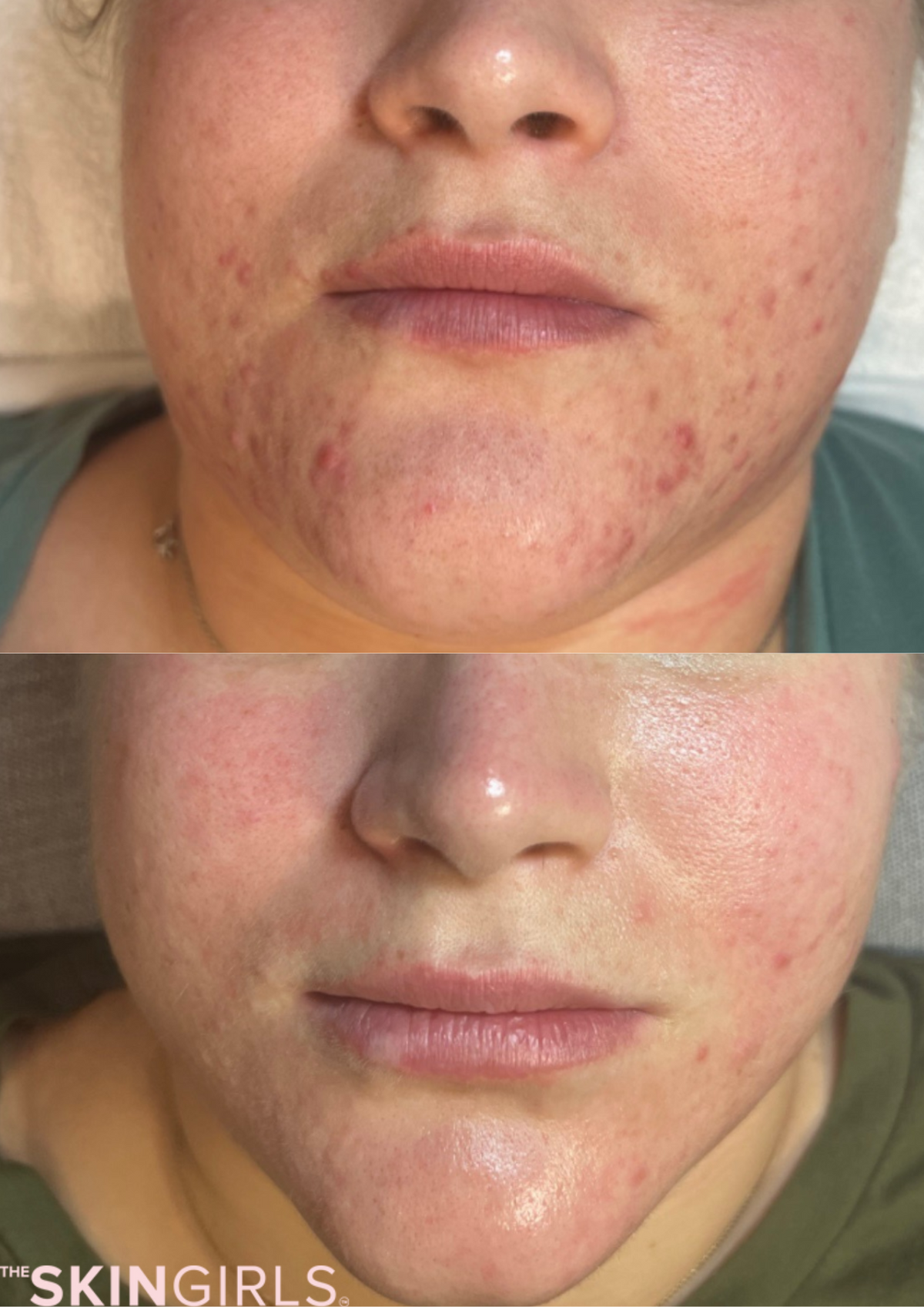 Treatment result
