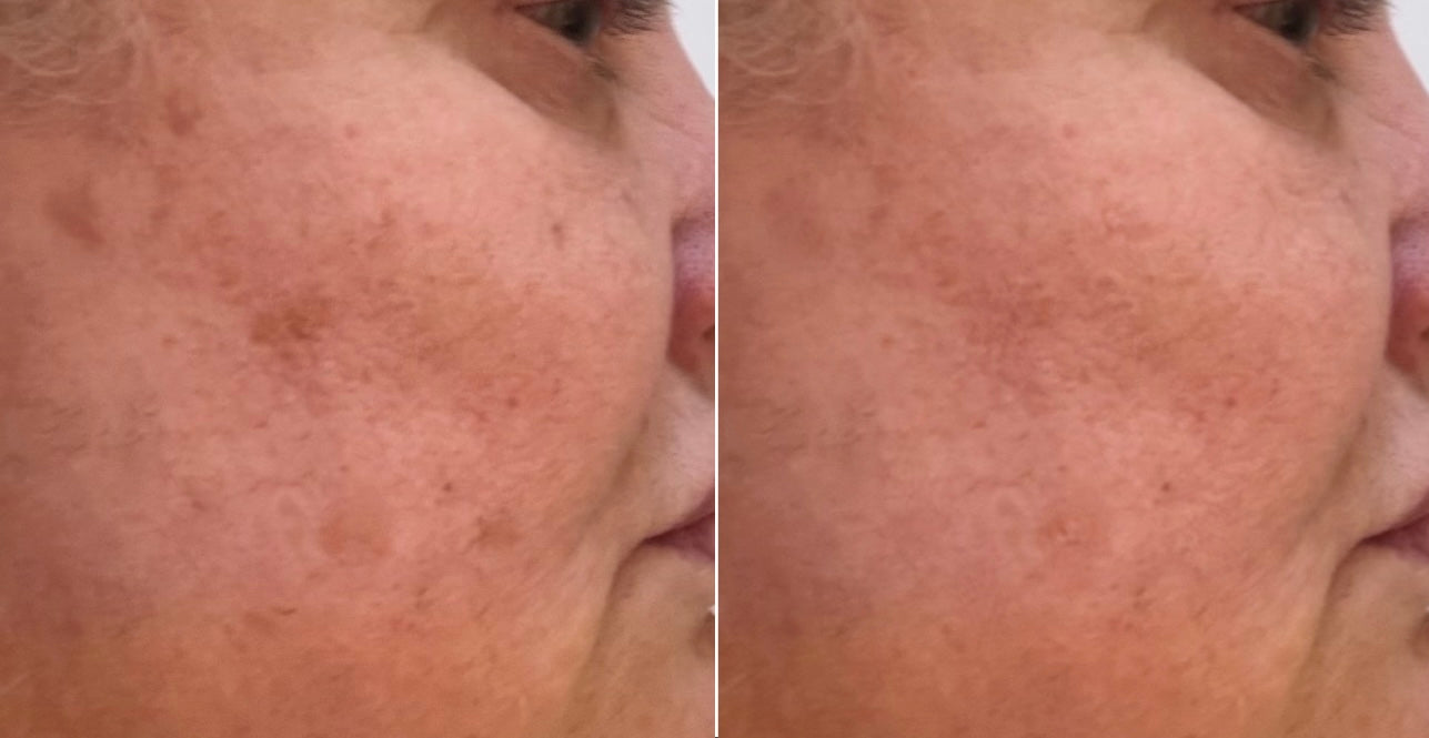 SkinEdition Hydrating Retinol