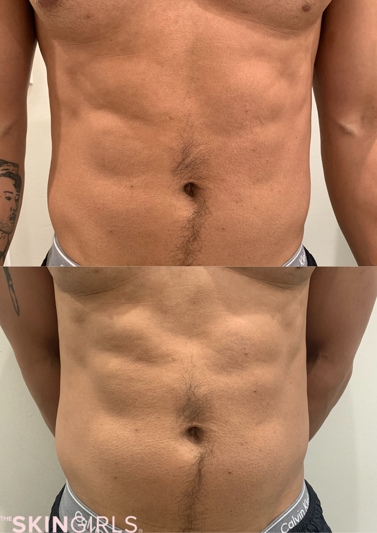Treatment result